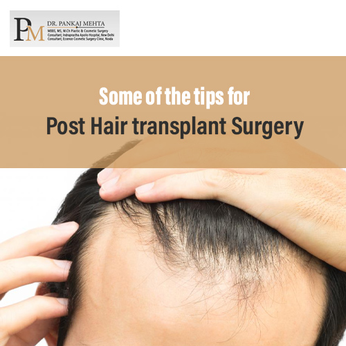 Some of the tips for Post Hair transplant Surgery - plastic surgeon pankaj